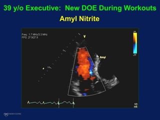 39 y/o Executive: New DOE During Workouts
Amyl Nitrite
 
