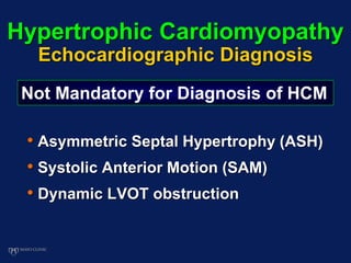 Hypertrophic Cardiomyopathy
Echocardiographic Diagnosis
• Asymmetric Septal Hypertrophy (ASH)
• Systolic Anterior Motion (SAM)
• Dynamic LVOT obstruction
Not Mandatory for Diagnosis of HCM
 