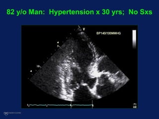 82 y/o Man: Hypertension x 30 yrs; No Sxs
 
