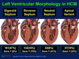 Left Ventricular Morphology in HCM
Binder J, et al. Mayo Clin Proc 2006; 81: 459.
181(47%)
Gene + (8%)
132(35%)
Gene + (79%)
37(10%)
Gene + (32%)
32(8%)
Gene + (41%)
Sigmoid
Septum
Reverse
Septum
Neutral
Septum
Apical
Variant
 