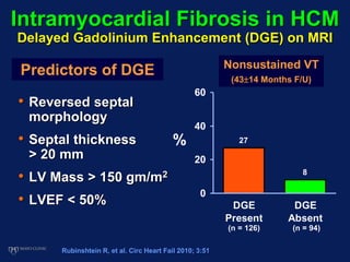 27
8
0
20
40
60
DGE
Present
DGE
Absent
Nonsustained VT
(4314 Months F/U)
%
(n = 126) (n = 94)
Rubinshtein R, et al. Circ Heart Fail 2010; 3:51
• Reversed septal
morphology
• Septal thickness
> 20 mm
• LV Mass > 150 gm/m2
• LVEF < 50%
Predictors of DGE
Intramyocardial Fibrosis in HCM
Delayed Gadolinium Enhancement (DGE) on MRI
 