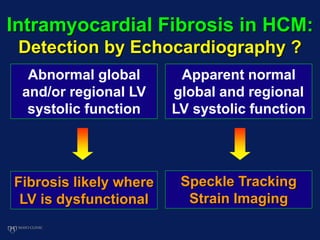 Intramyocardial Fibrosis in HCM:
Detection by Echocardiography ?
Speckle Tracking
Strain Imaging
Apparent normal
global and regional
LV systolic function
Abnormal global
and/or regional LV
systolic function
Fibrosis likely where
LV is dysfunctional
 