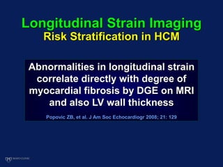 Longitudinal Strain Imaging
Risk Stratification in HCM
Abnormalities in longitudinal strain
correlate directly with degree of
myocardial fibrosis by DGE on MRI
and also LV wall thickness
Popovic ZB, et al. J Am Soc Echocardiogr 2008; 21: 129
 