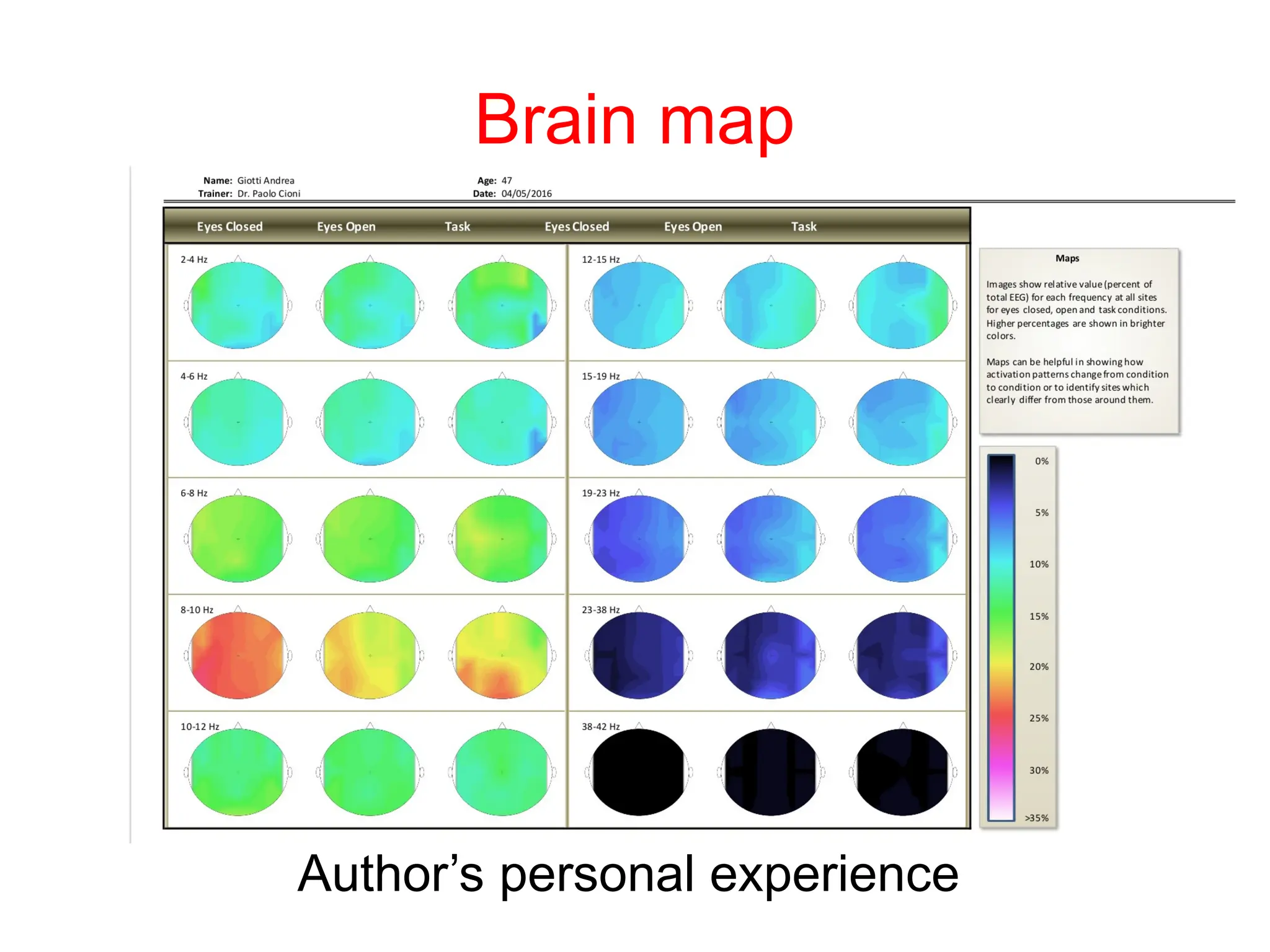 Author’s personal experience
Brain map
 