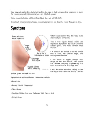 You may not realize this, but what is often the case is that when medical treatment is given
for cancer removal, it does not always get rid of all cancer.
Some cancer is hidden within cells and just does not get killed off.
Despite all misconceptions, breast cancer is dangerous but it can be cured if caught in time.
When breast cancer first develops, there
are usually no symptoms.
This is why regular breast exams are
important. Symptoms do occur when the
cancer grows. The most common ones
include:
• A lump in the breast or in the armpit
that is hard, has uneven edges, and
usually does not hurt,
• The breast or nipple changes size,
shape, or feel. With cancer, your breast
has redness, dimpling, or puckering that
looks like the skin of an orange and
• You will often see fluid coming out of
the nipple and it may be bloody, clear to
yellow, green and look like pus.
Symptoms of advanced breast cancer may include:
• Bone Pain
• Breast Pain Or Discomfort
• Skin Ulcers
• Swelling Of One Arm Next To Breast With Cancer And
• Weight Loss
5
 