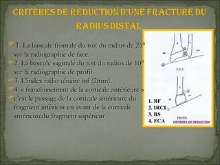 1. BF 2. IRCI 3. BS 4. FCA 1 . La bascule frontale du toit du radius de 25° sur la radiographie de face. 2. La bascule sagittale du toit du radius de 10° sur la radiographie de profil. 3. L’index radio ulnaire inf (2mm). 4. « franchissement de la corticale antérieure »  c’est le passage de la corticale antérieure du fragment inférieur en avant de la corticale antérieuredu fragment supérieur  