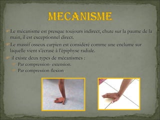 Le mécanisme est presque toujours indirect, chute sur la paume de la main, il est exceptionnel direct. Le massif osseux carpien est considéré comme une enclume sur laquelle vient s’écrasé à l’épiphyse radiale. il existe deux types de mécanismes :  Par compression- extension. Par compression flexion . 