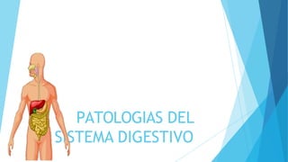 PATOLOGIAS DEL
SISTEMA DIGESTIVO
 