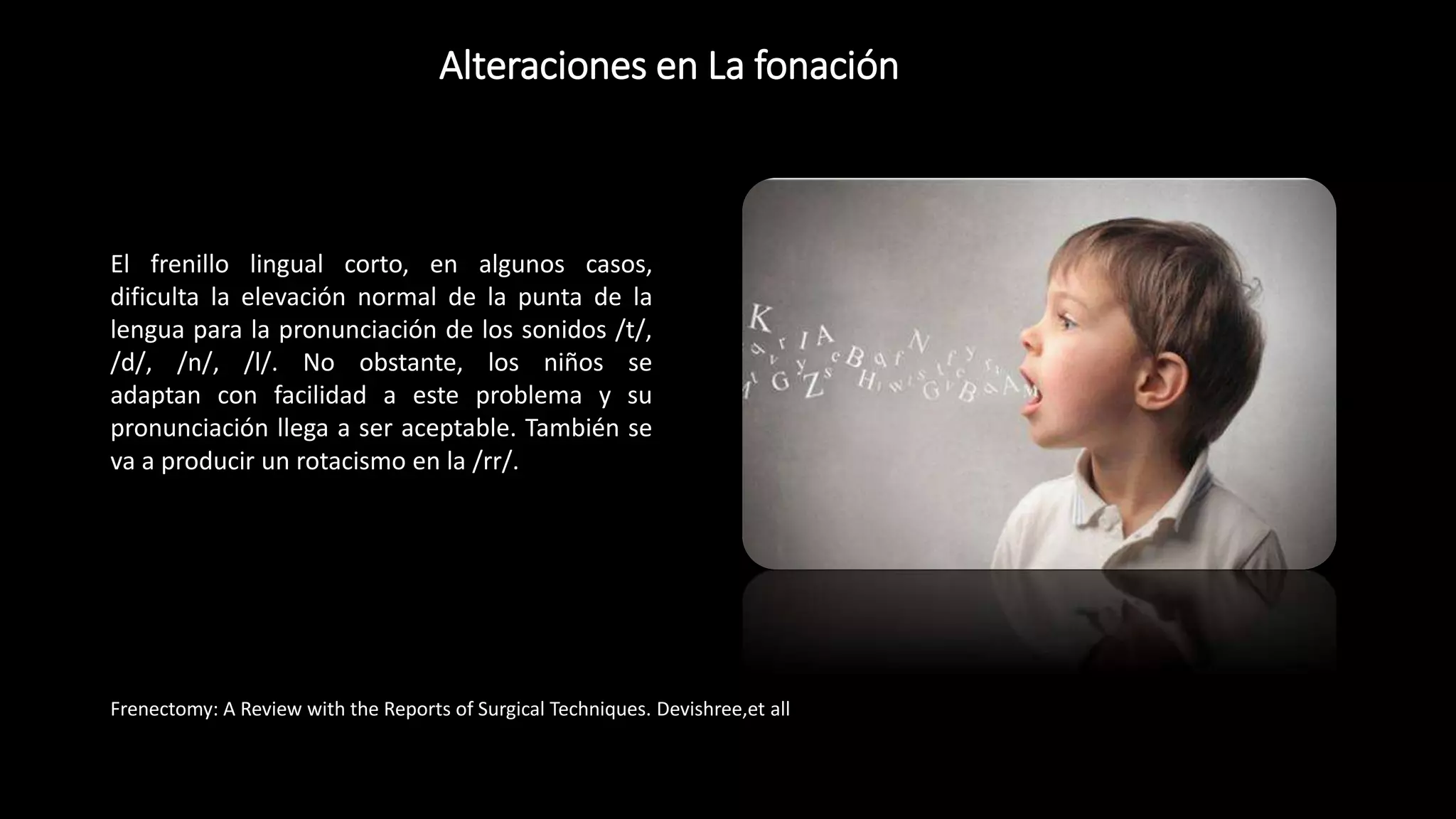 Alteraciones en La fonación
Frenectomy: A Review with the Reports of Surgical Techniques. Devishree,et all
El frenillo lingual corto, en algunos casos,
dificulta la elevación normal de la punta de la
lengua para la pronunciación de los sonidos /t/,
/d/, /n/, /l/. No obstante, los niños se
adaptan con facilidad a este problema y su
pronunciación llega a ser aceptable. También se
va a producir un rotacismo en la /rr/.
 