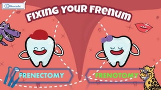 FRENECTOMY FRENOTOMY
 