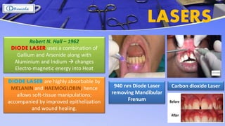 LASERS
940 nm Diode Laser
removing Mandibular
Frenum
Robert N. Hall – 1962
DIODE LASER uses a combination of
Gallium and Arsenide along with
Aluminium and Indium  changes
Electro-magnetic energy into Heat
DIODE LASER are highly absorbable by
MELANIN and HAEMOGLOBIN, hence
allows soft-tissue manipulations;
accompanied by improved epithelization
and wound healing.
Carbon dioxide Laser
 