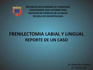 REPUBLICA BOLIVARIANA DE VENEZUELA
UNIVERSIDAD JOSE ANTONIO PAEZ
FACULTAD DE CIENCIAS DE LA SALUD
ESCUELA DE ODONTOLOGIA

FRENILECTOMIA LABIAL Y LINGUAL
REPORTE DE UN CASO

Br. Alexander Rosario
CI: 18.812.181

 
