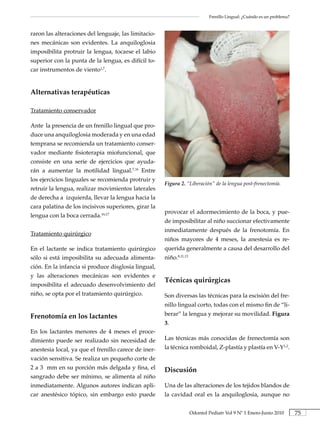 Frenillo Lingual: ¿Cuándo es un problema?



raron las alteraciones del lenguaje, las limitacio-
nes mecánicas son evidentes. La anquiloglosia
imposibilita protruir la lengua, tocarse el labio
superior con la punta de la lengua, es difícil to-
car instrumentos de viento1,7.


Alternativas.terapéuticas

Tratamiento conservador

Ante la presencia de un frenillo lingual que pro-
duce una anquiloglosia moderada y en una edad
temprana se recomienda un tratamiento conser-
vador mediante fisioterapia miofuncional, que
consiste en una serie de ejercicios que ayuda-
rán a aumentar la motilidad lingual.7,16 Entre
los ejercicios linguales se recomienda protruir y
                                                      Figura 2. “Liberación” de la lengua post-frenectomía.
retruir la lengua, realizar movimientos laterales
de derecha a izquierda, llevar la lengua hacia la
cara palatina de los incisivos superiores, girar la
                                                      provocar el adormecimiento de la boca, y pue-
lengua con la boca cerrada.16,17
                                                      de imposibilitar al niño succionar efectivamente
                                                      inmediatamente después de la frenotomía. En
Tratamiento quirúrgico
                                                      niños mayores de 4 meses, la anestesia es re-
En el lactante se indica tratamiento quirúrgico       querida generalmente a causa del desarrollo del
sólo si está imposibilita su adecuada alimenta-       niño.8,11,13
ción. En la infancia si produce disglosia lingual,
y las alteraciones mecánicas son evidentes e
                                                      Técnicas.quirúrgicas
imposibilita el adecuado desenvolvimiento del
niño, se opta por el tratamiento quirúrgico.          Son diversas las técnicas para la escisión del fre-
                                                      nillo lingual corto, todas con el mismo fin de “li-
Frenotomía.en.los.lactantes                           berar” la lengua y mejorar su movilidad. Figura.
                                                      3.
En los lactantes menores de 4 meses el proce-
dimiento puede ser realizado sin necesidad de         Las técnicas más conocidas de frenectomía son
anestesia local, ya que el frenillo carece de iner-   la técnica romboidal, Z-plastía y plastía en V-Y1,2.
vación sensitiva. Se realiza un pequeño corte de
2 a 3 mm en su porción más delgada y fina, el         Discusión
sangrado debe ser mínimo, se alimenta al niño
inmediatamente. Algunos autores indican apli-         Una de las alteraciones de los tejidos blandos de
car anestésico tópico, sin embargo esto puede         la cavidad oral es la anquiloglosia, aunque no


                                                                     Odontol Pediatr Vol 9 Nº 1 Enero-Junio 2010         75
 