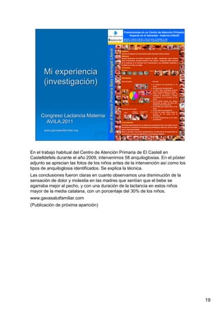 19
LuisRuizGuzmLuisRuizGuzmáán,n,GavGavààSalutSalutFamiliar(Familiar(www.gavasalutfamiliar.comwww.gavasalutfamiliar.com)11)11--XIXI--20112011
Congreso Lactancia MaternaCongreso Lactancia Materna
AVILA.2011AVILA.2011
www.gavasalutfamiliar.orgwww.gavasalutfamiliar.org
Mi experienciaMi experiencia
(investigaci(investigacióón)n)
Frenectomías en un Centro de Atención Primaria:
Impacto en el bienestar materno-infantil
Autores: S. Catalan, N. Murillo, L. Ruiz, M. Carrau, N. Parellada, C. Diaz.
Equipo de Atención Primaria El Castell. Castelldefels. Barcelona
Serveid’AtencióPrimàriaBaixLlobregatLitoral
Institut Català de la Salut
Objetivo
Conocer el impacto de la frenectomía sobre bienestar materno-infantil.
Métodos
Estudio descriptivo de frenillos linguales del 2009. Clasificados según Watson
Gena. Frenectomía, encuesta posterior a las madres. Preguntas sobre situación
de la lactancia en el momento de la intervención y los resultados obtenidos y
sentidos en el niño y la madre.
Resultados
31,03%
15,52%
39,66%
3,45%
10,34%
Tipo I Tipo II Tipo III Tipo IV Sin registro
Conclusiones
El frenillo lingual genera en las madres que amamantan dolor, que mejora tras la
frenectomía. La duración de la lactancia se prolonga por más de un año en el 30%
de los niños intervenidos.
Dada la sencillez y las pocas complicaciones, la intervención de frenectomía es
una técnica a usar por los pediatras en la puericultura habitual.
Se realizaron 58 frenectomías en <6
meses
Se entrevistó a 40 madres (69%)
12 (30%) niños continuaban tomando
pecho con edad media de 12,3 meses
Cuatro (10%) no tomaban pecho al
realizarse la intervención y notaron
acortamiento en la duración de las
tomas
De 25 (62,5%) madres que referían
dificultades de agarre del pecho 95%
mejoraron tras la frenectomía
De 34 (85%) que referían dolor en las
tomas
El 91% refieren su desaparición
El 68% de madres refería acortar la
duración de las tomas tras la
frenectomía
No hubo complicaciones y en 6 casos
se reintervino
Materiales
Frenectomía
Técnica
Resultados de la cirugía
Antes
Posterior
immediato
Posterior 48
horas
Tipos de frenillo Encuesta
En el trabajo habitual del Centro de Atención Primaria de El Castell en
Castelldefels durante el año 2009, intervenimos 58 anquiloglosias. En el póster
adjunto se aprecian las fotos de los niños antes de la intervención así como los
tipos de anquiloglosia identificados. Se explica la técnica.
Las conclusiones fueron claras en cuanto observamos una disminución de la
sensación de dolor y molestia en las madres que sentían que el bebe se
agarraba mejor al pecho, y con una duración de la lactancia en estos niños
mayor de la media catalana, con un porcentaje del 30% de los niños.
www.gavasalutfamiliar.com
(Publicación de próxima aparición)
 