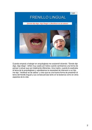 2
LuisRuizGuzmLuisRuizGuzmáán,n,GavGavààSalutSalutFamiliar(Familiar(www.gavasalutfamiliar.comwww.gavasalutfamiliar.com)11)11--XIXI--20112011
FRENILLO LINGUALFRENILLO LINGUAL
¡Donde dije digo, digo Diego! o ¡Rectificar es de sabios!
Cuando empecé a trabajar en anquiloglosia me sorprendí diciendo: “Donde dije
digo, digo diego”, refrán muy usado por todos cuando cambiamos una forma de
pensar o actuar que son totalmente diferentes. Una madre, cuando le explicaba
el tema de la anquiloglosia y valorábamos la necesidad de intervenir a su hijo,
me dijo: ”rectificar es de sabios” y creo que es una buena forma de presentar el
tema del frenillo lingual y sus consecuencias tanto en la lactancia como en otros
aspectos de la vida.
 