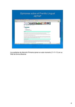 4
LuisRuizGuzmLuisRuizGuzmáán,n,GavGavààSalutSalutFamiliar(Familiar(www.gavasalutfamiliar.comwww.gavasalutfamiliar.com)11)11--XIXI--20112011
Opiniones sobre el Frenillo LingualOpiniones sobre el Frenillo Lingual
AEPAPAEPAP
Los pediatras de Atención Primaria opinan en este momento (11-11-11) en su
Web de forma diferente.
 