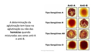 A determinação da
aglutinação tem base na
aglutinação ou não das
hemácias quando
misturadas aos soros anti-A
e anti-B.
Prof Zayra Prado Almondes
 