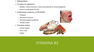VITAMINA B3
 
