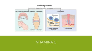 VITAMINA C
 
