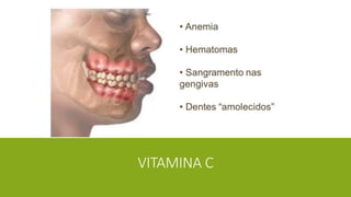 VITAMINA C
 