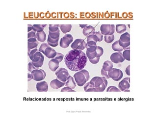 LEUCÓCITOS: EOSINÓFILOS
Prof Zayra Prado Almondes
 