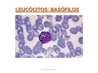 LEUCÓCITOS: BASÓFILOS
Prof Zayra Prado Almondes
 