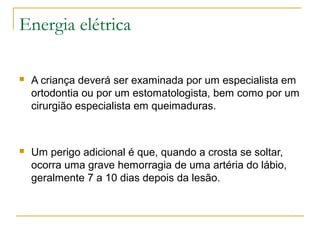 Energia elétrica

   A criança deverá ser examinada por um especialista em
    ortodontia ou por um estomatologista, bem como por um
    cirurgião especialista em queimaduras.



   Um perigo adicional é que, quando a crosta se soltar,
    ocorra uma grave hemorragia de uma artéria do lábio,
    geralmente 7 a 10 dias depois da lesão.
 