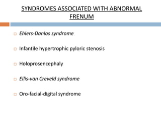 SYNDROMES ASSOCIATED WITH ABNORMAL
FRENUM
 Ehlers-Danlos syndrome
 Infantile hypertrophic pyloric stenosis
 Holoprosencephaly
 Ellis-van Creveld syndrome
 Oro-facial-digital syndrome
 