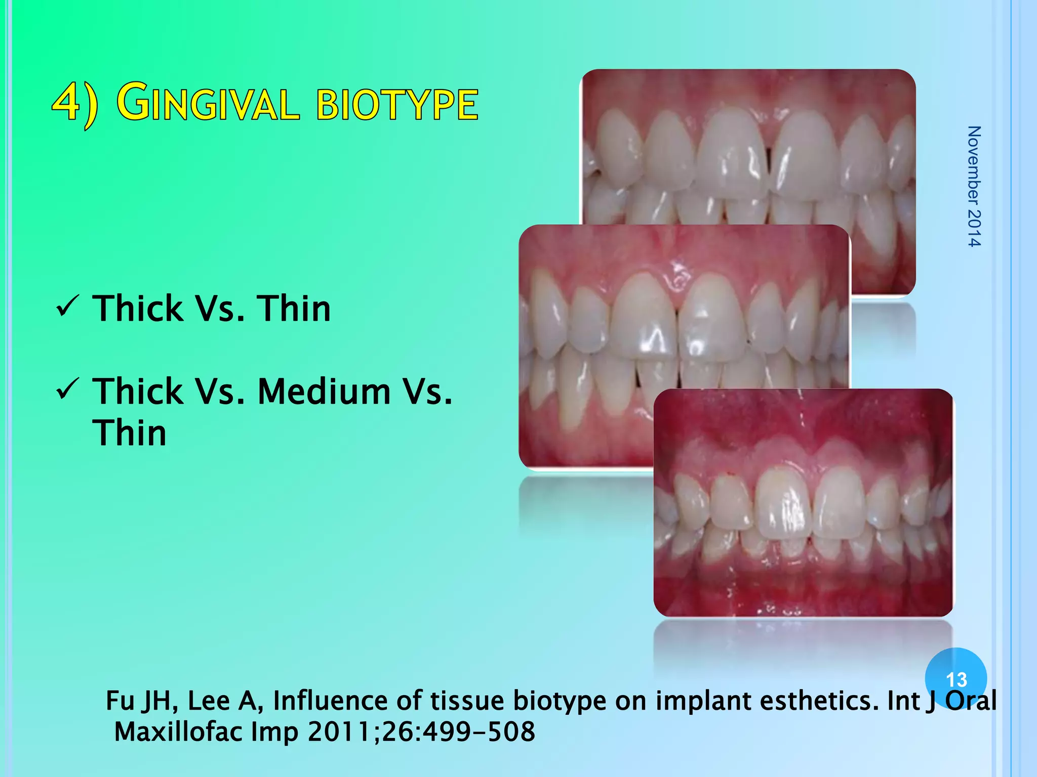 Fresh socket implant placement | PPTX