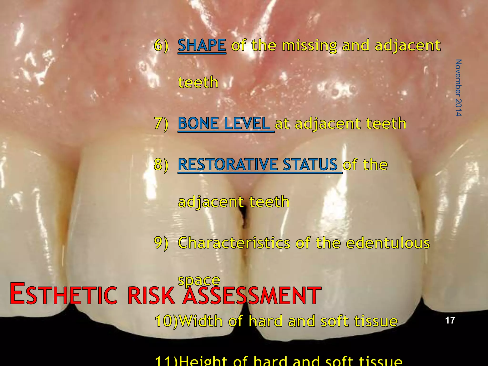Fresh socket implant placement | PPTX