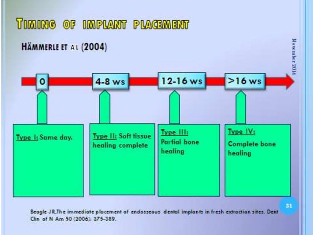 Fresh socket implant placement | PPTX