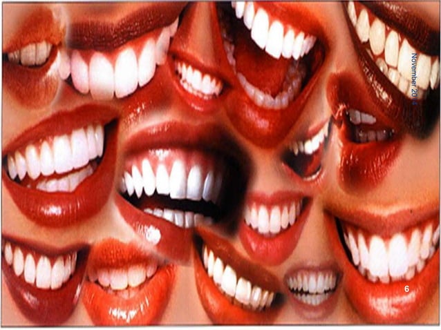 Fresh socket implant placement | PPTX