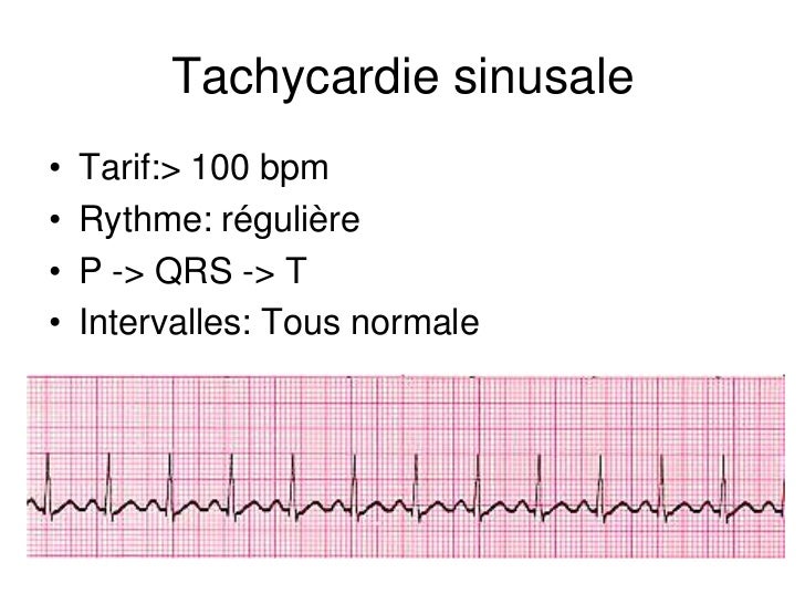 Base ECG et l'interprétation du rythme (French) Symposia