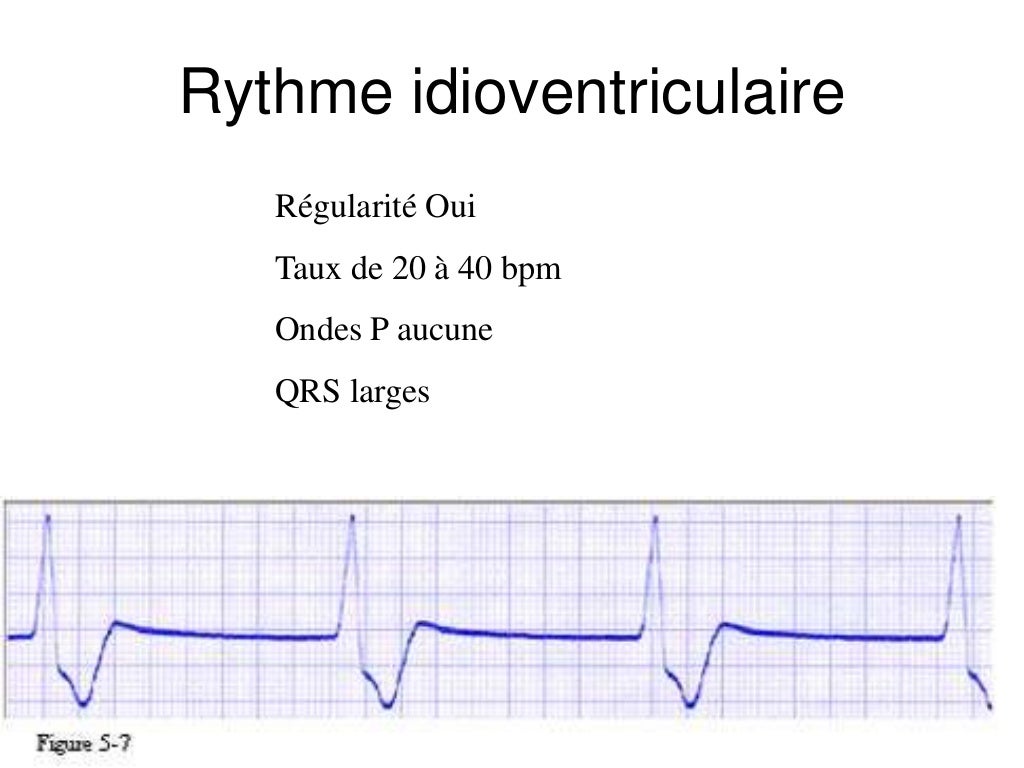 Base ECG et l'interprétation du rythme (French) Symposia