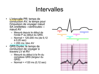 Intervalles
• L'intervalle PR: temps de
  conduction AV, le temps pour
  l'impulsion de voyager nœud
  SA oreillettes→ventricules→
  nœud AV
   – Mesuré depuis le début de
     l'onde P au début du QRS.
   – Normal = 120-200 ms (de 0,12
     à 0,20 sec)
   – > 200 ms: bloc AV
• QRS Durée: le temps de
  conduction de voyager à
  travers LV et RV
   – Mesuré du début à la fin du
     complexe QRS (largeur du
     QRS)
   – Normal = <120 ms (0,12 sec)
 