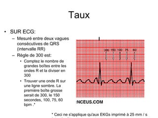 Taux
• SUR ECG:
  – Mesuré entre deux vagues
    consécutives de QRS
    (intervalle RR)                               300 150 100 75   60
  – Règle de 300 est:
     • Comptez le nombre de
       grandes boîtes entre les
       ondes R et la diviser en
       300
     • Trouver une onde R sur
       une ligne sombre. La
       première boîte grosse
       serait de 300, le 150
       secondes, 100, 75, 60
       bpm .*

                      * Ceci ne s'applique qu'aux EKGs imprimé à 25 mm / s
 
