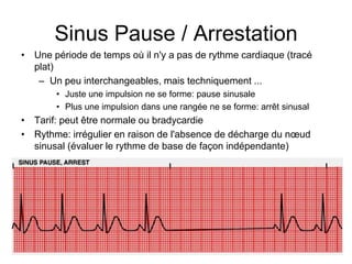 Sinus Pause / Arrestation
• Une période de temps où il n'y a pas de rythme cardiaque (tracé
  plat)
   – Un peu interchangeables, mais techniquement ...
       • Juste une impulsion ne se forme: pause sinusale
       • Plus une impulsion dans une rangée ne se forme: arrêt sinusal
• Tarif: peut être normale ou bradycardie
• Rythme: irrégulier en raison de l'absence de décharge du nœud
  sinusal (évaluer le rythme de base de façon indépendante)
 