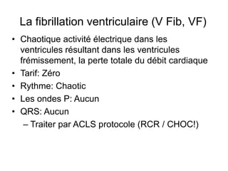 La fibrillation ventriculaire (V Fib, VF)
• Chaotique activité électrique dans les
  ventricules résultant dans les ventricules
  frémissement, la perte totale du débit cardiaque
• Tarif: Zéro
• Rythme: Chaotic
• Les ondes P: Aucun
• QRS: Aucun
   – Traiter par ACLS protocole (RCR / CHOC!)
 