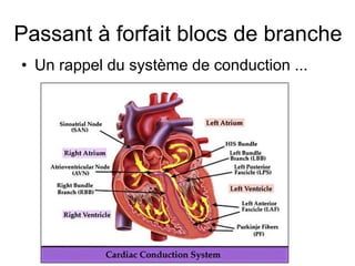 Passant à forfait blocs de branche
• Un rappel du système de conduction ...
 