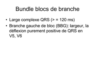 Bundle blocs de branche
• Large complexe QRS (> = 120 ms)
• Branche gauche de bloc (BBG): largeur, la
  déflexion purement positive de QRS en
  V5, V6
 