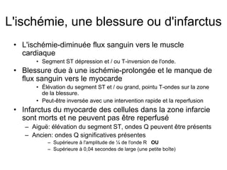 L'ischémie, une blessure ou d'infarctus
 • L'ischémie-diminuée flux sanguin vers le muscle
   cardiaque
       • Segment ST dépression et / ou T-inversion de l'onde.
 • Blessure due à une ischémie-prolongée et le manque de
   flux sanguin vers le myocarde
       • Élévation du segment ST et / ou grand, pointu T-ondes sur la zone
         de la blessure.
       • Peut-être inversée avec une intervention rapide et la reperfusion
 • Infarctus du myocarde des cellules dans la zone infarcie
   sont morts et ne peuvent pas être reperfusé
    – Aiguë: élévation du segment ST, ondes Q peuvent être présents
    – Ancien: ondes Q significatives présentes
           – Supérieure à l'amplitude de ¼ de l'onde R OU
           – Supérieure à 0,04 secondes de large (une petite boîte)
 