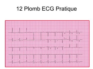 12 Plomb ECG Pratique
 