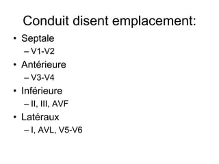 Conduit disent emplacement:
• Septale
  – V1-V2
• Antérieure
  – V3-V4
• Inférieure
  – II, III, AVF
• Latéraux
  – I, AVL, V5-V6
 