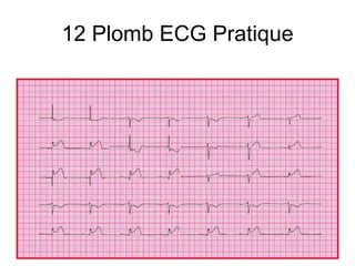 12 Plomb ECG Pratique
 