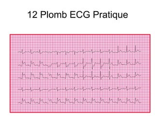 12 Plomb ECG Pratique
 