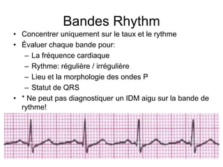 Bandes Rhythm
• Concentrer uniquement sur le taux et le rythme
• Évaluer chaque bande pour:
   – La fréquence cardiaque
   – Rythme: régulière / irrégulière
   – Lieu et la morphologie des ondes P
   – Statut de QRS
• * Ne peut pas diagnostiquer un IDM aigu sur la bande de
  rythme!
 