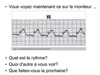 • Vous voyez maintenant ce sur le moniteur ...




• Quel est le rythme?
• Quoi d'autre à vous voir?
• Que faites-vous la prochaine?
 
