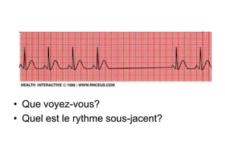 • Que voyez-vous?
• Quel est le rythme sous-jacent?
 