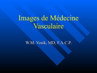 Images de Médecine Vasculaire W.M. Vosik, MD, F.A.C.P. 