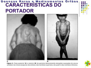 CARACTERÍSTICAS DO
PORTADOR
 